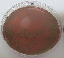 圖 2 　以培養法及聚合酶連鎖反應（ PCR ）檢測 30 克堆肥中 10 1 細菌量 。沙門氏桿菌（上）與出血性大腸桿菌（下） 