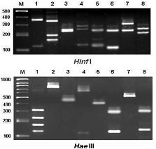 圖4  利用限制酶Hinf I（上）與Hae III（下）可以將ITS切成八種不同大小片段型式